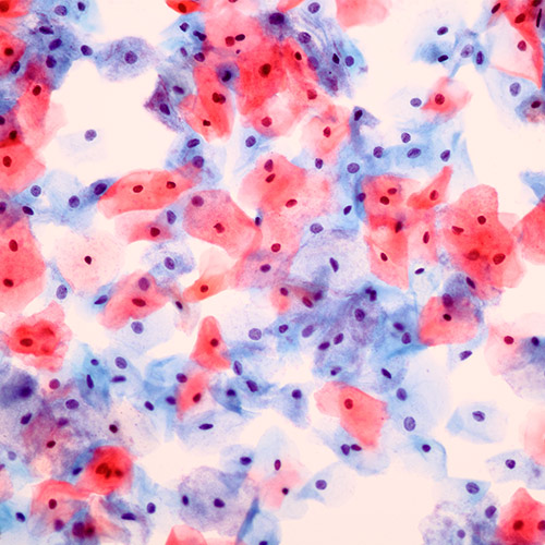 Pathology